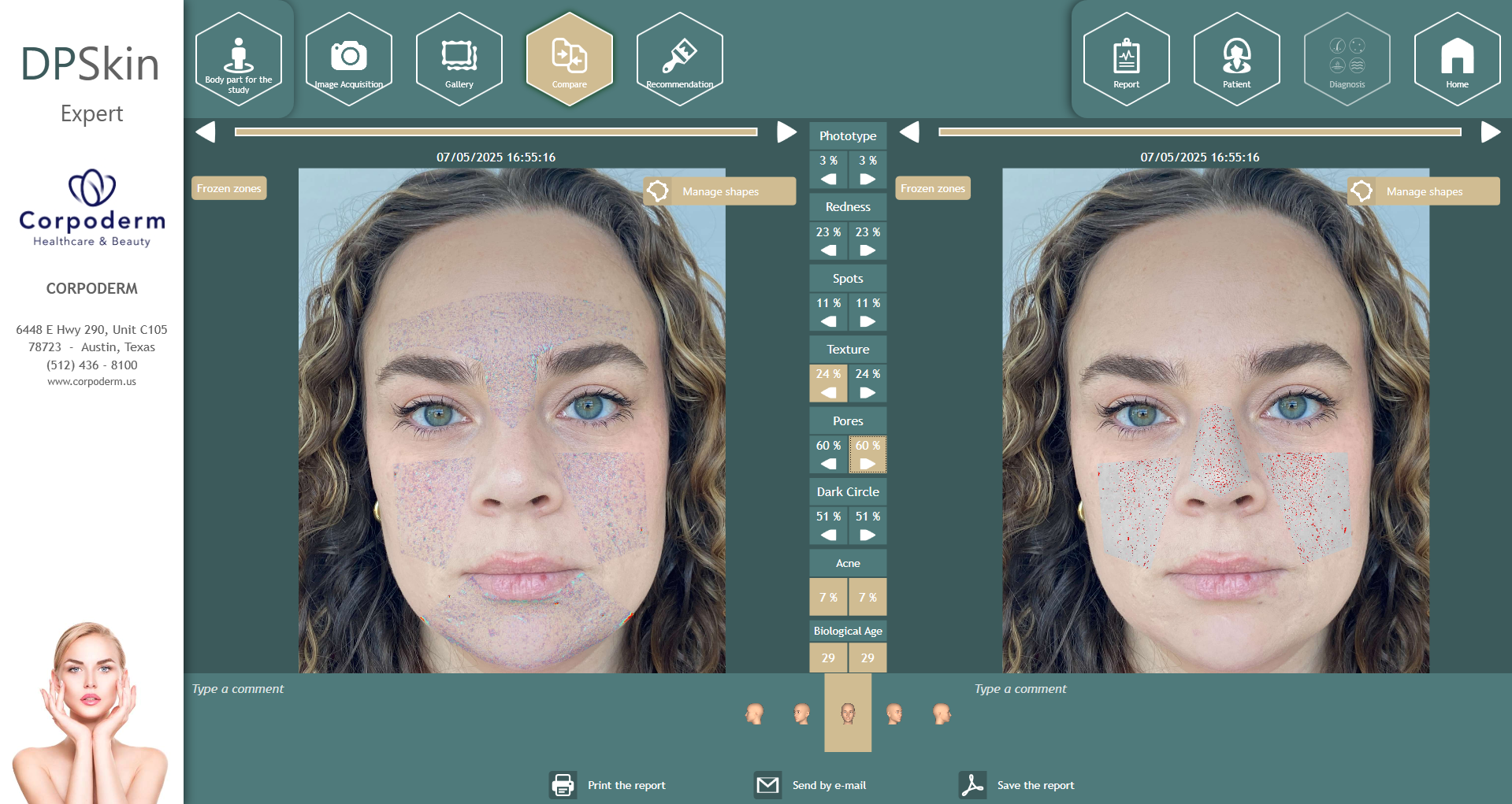 Dpskin-essentials-by-corpoderm-analysis-made-in-france2