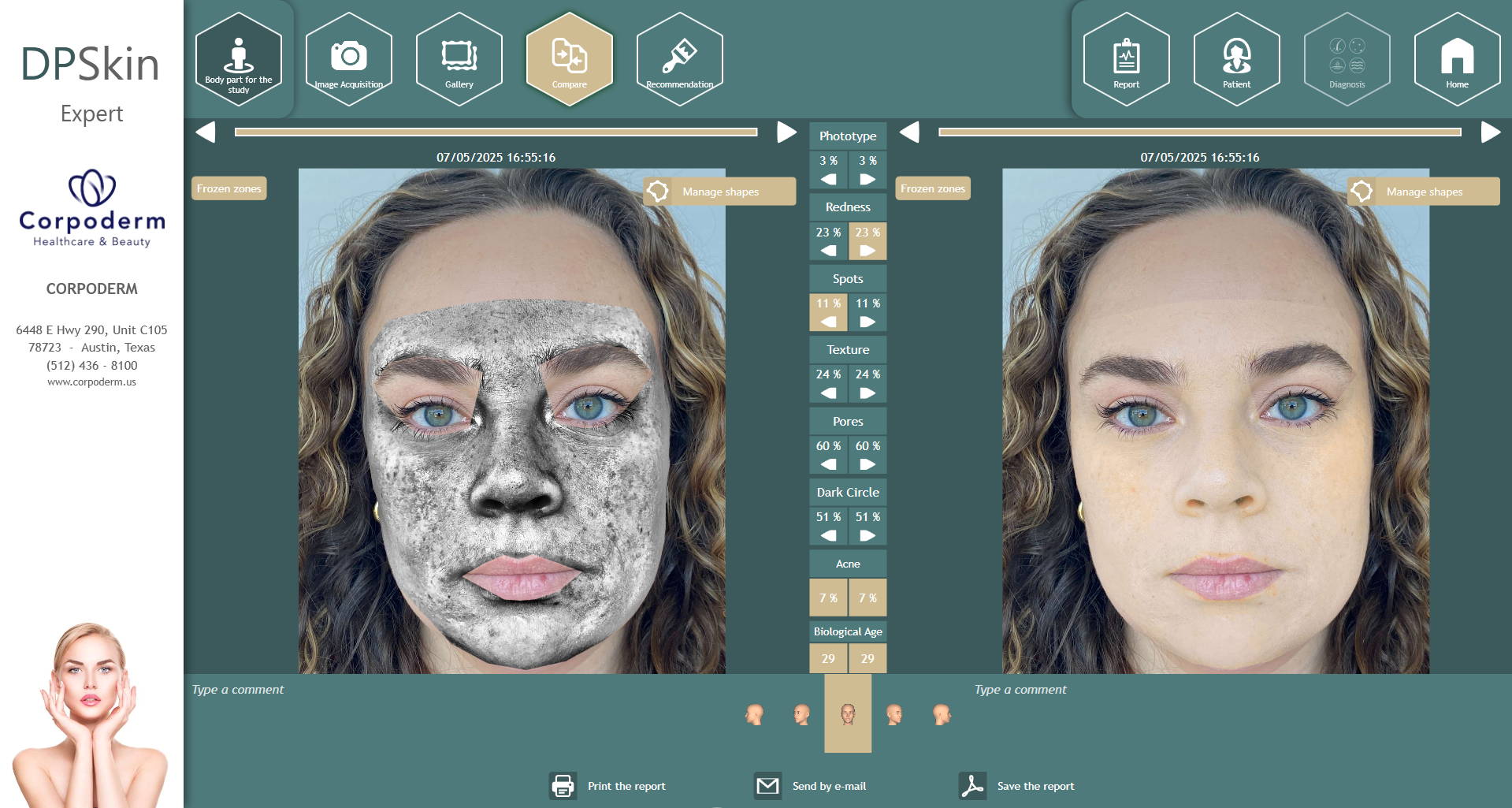 Dpskin-essentials-by-corpoderm-analysis-made-in-france3