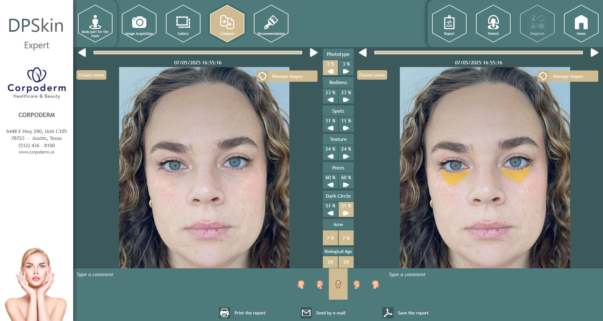 Dpskin-essentials-by-corpoderm-analysis-made-in-france4