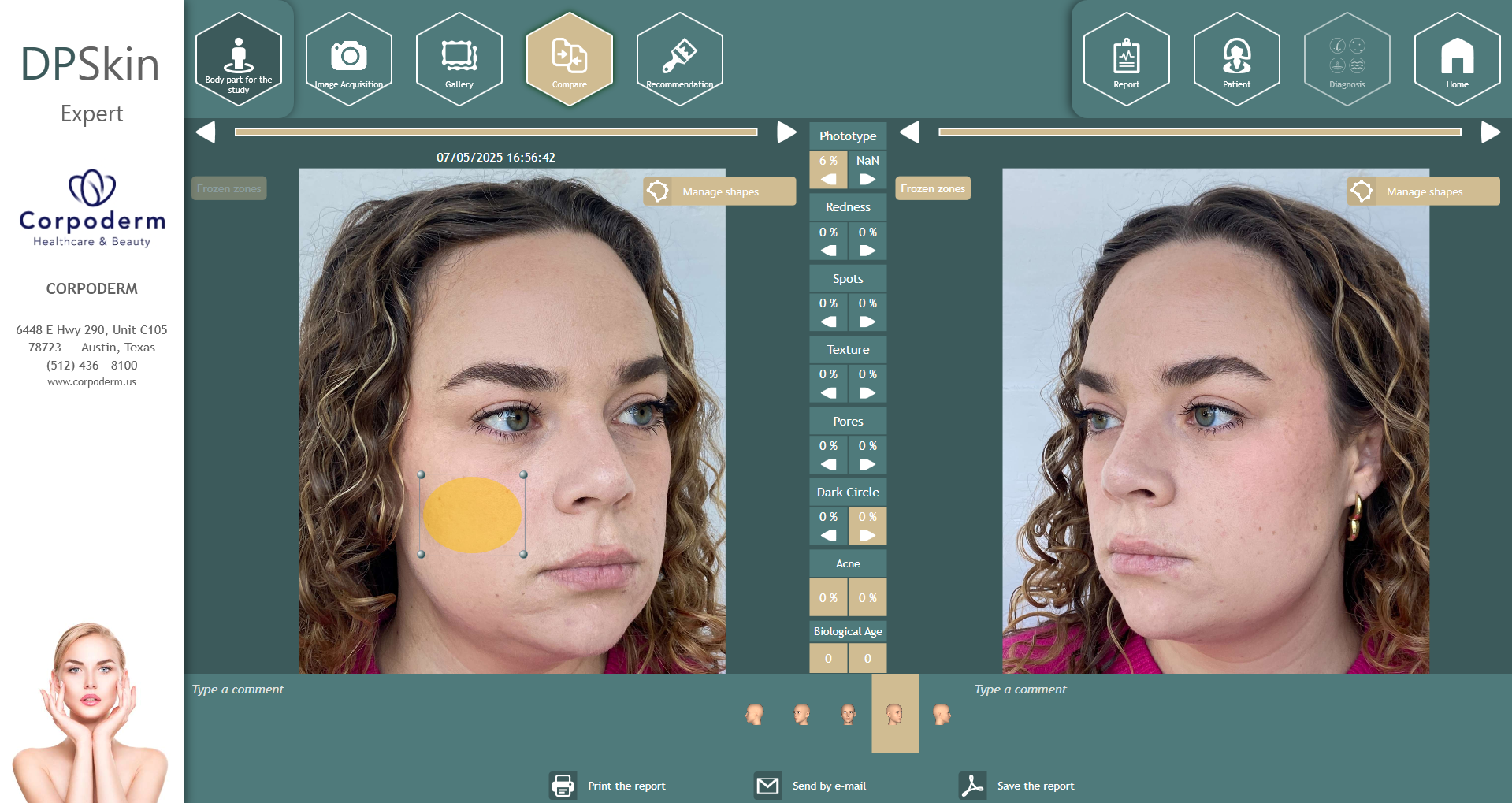Dpskin-essentials-by-corpoderm-analysis-made-in-france5