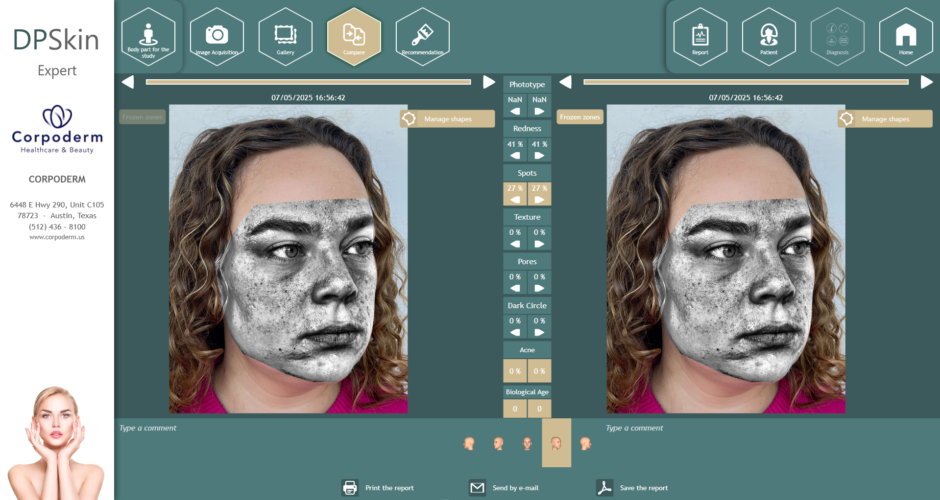 Dpskin-essentials-by-corpoderm-analysis-made-in-france6