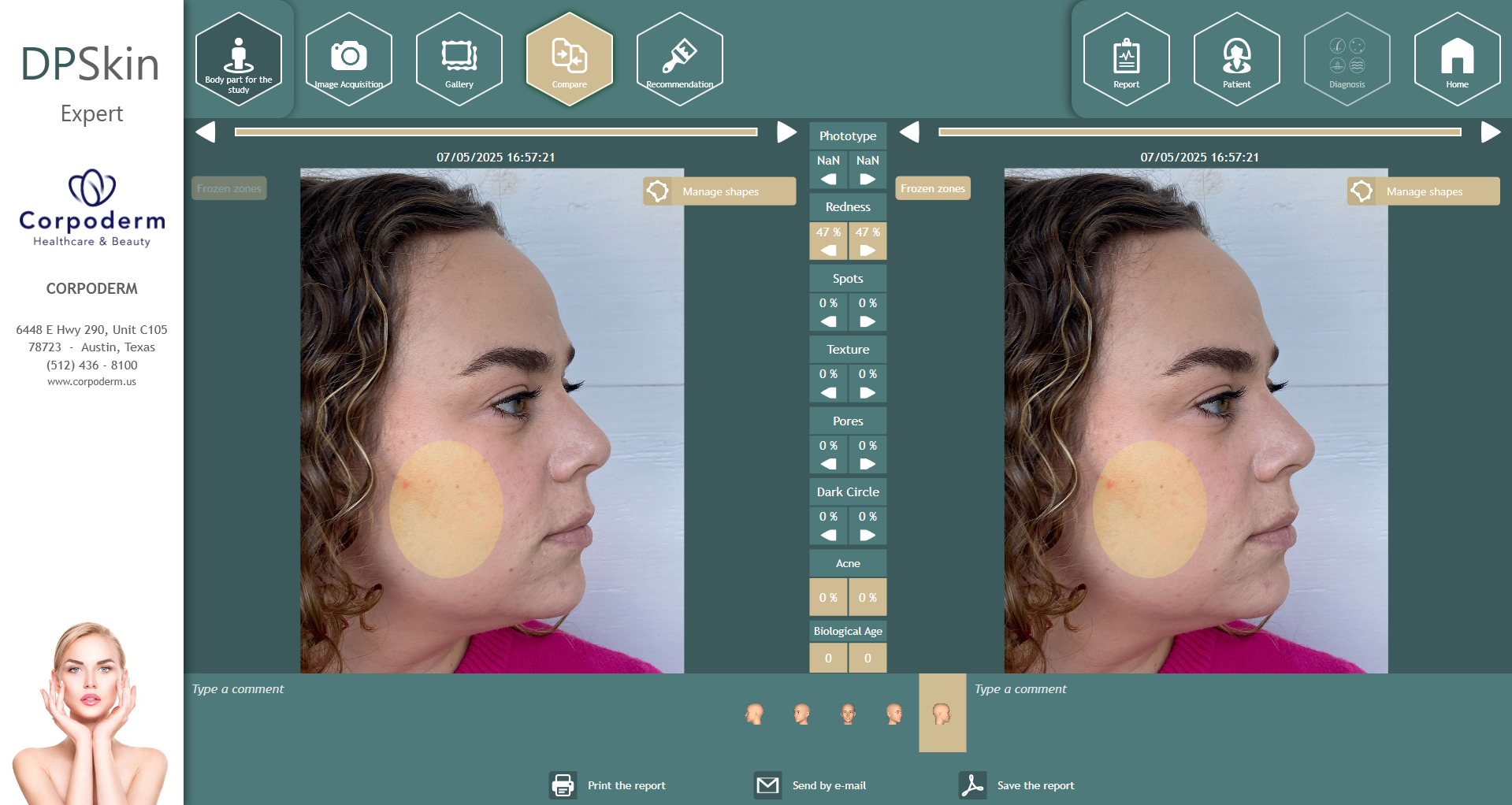 Dpskin-essentials-by-corpoderm-analysis-made-in-france7