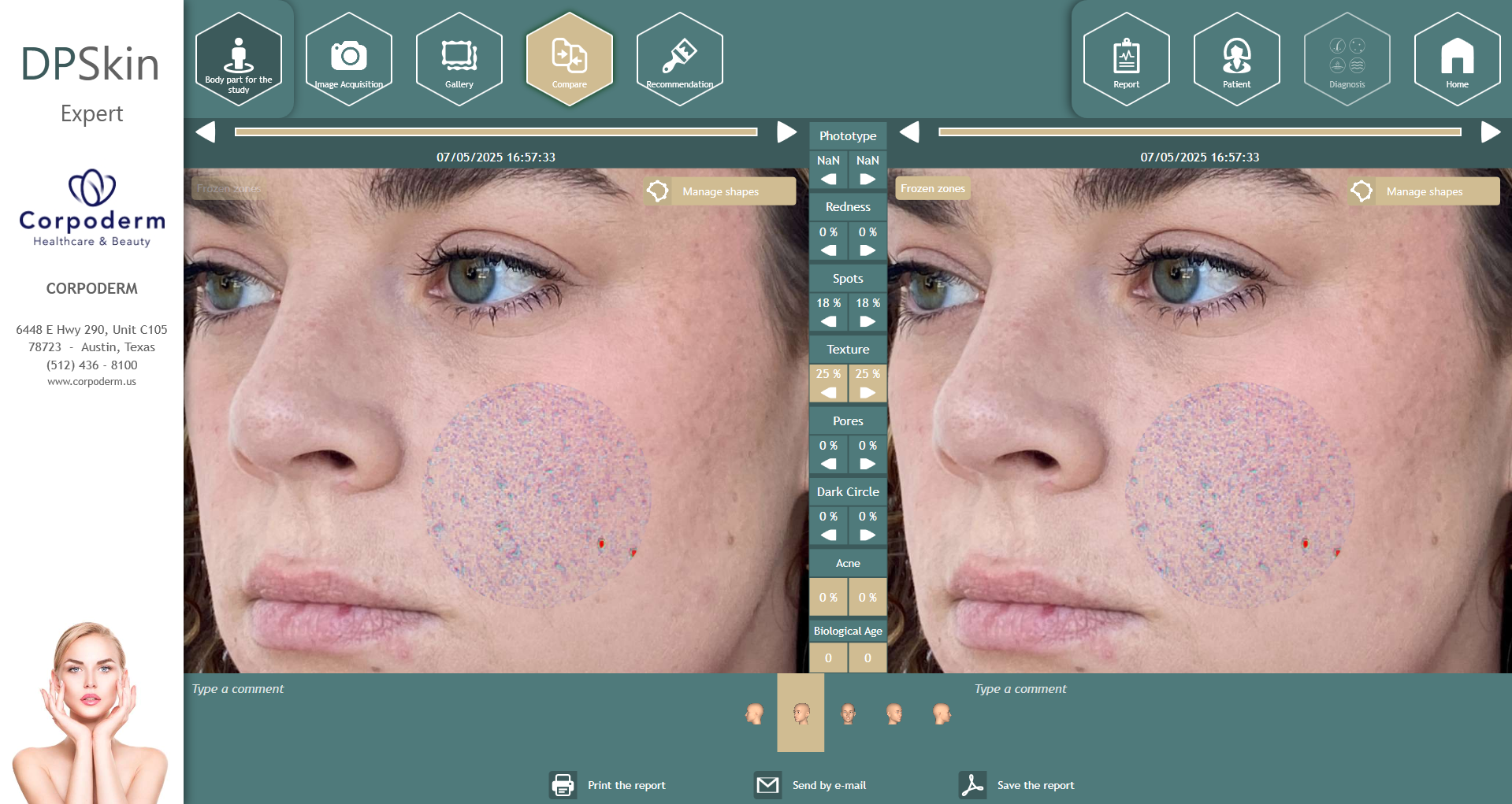 Dpskin-essentials-by-corpoderm-analysis-made-in-france8